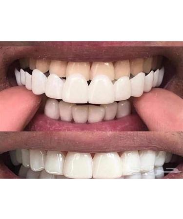 Wfle Instant Veneers - 2 Pair Dental Silicone Prostheses for Teeth Whitening & Temporary Dentures for Men & Women - Buy Online on GoSupps.com