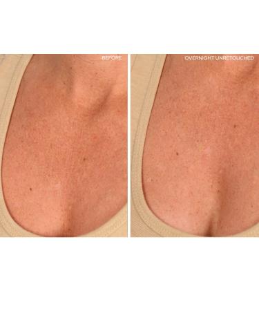 SiO Beauty SkinPad Silicone Chest Anti-Wrinkle Patches - 2 Weeks Supply - Buy Online on GoSupps.com