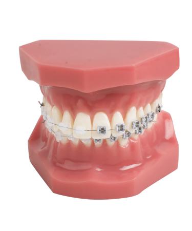 TM-208 Demonstration Orthodontic Model Teeth Teach Study Tools with Metal and Ceramic Bracket(Red)
