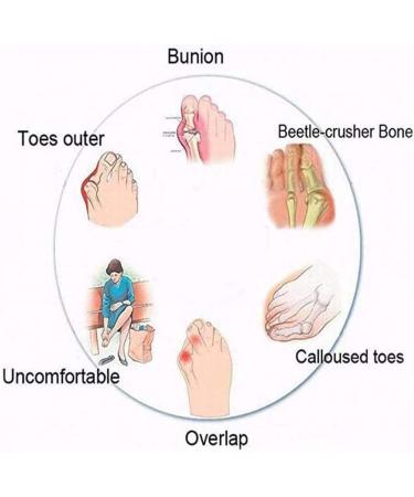 Creev Women's Orthopedic Sandals - Casual Flower Flat Slip-On Beach Travel Shoes | Ergonomic Flip-Flops in Gray & Dark Green (EU Sizes 38 & 42) - Buy Online on GoSupps.com