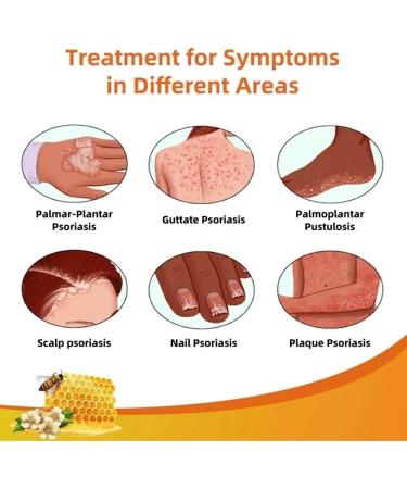 Bee Venom Psoriasis Treatment Cream - Soothing Moisturizer for Skin - Professional New Zealand Formula (5pcs) - Buy Online on GoSupps.com