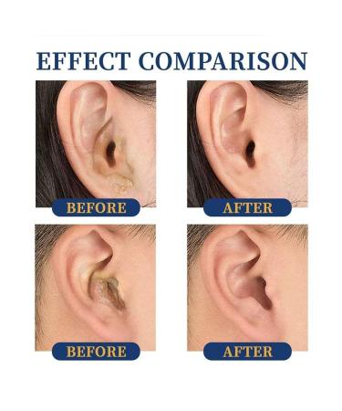 Ear Ringing Relief Drops | Tinnitus Treatment Oil for Deafness & Earache | Natural Hearing Care Solution - Buy Online on GoSupps.com