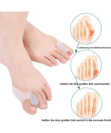 Xinshibao 8x Hallux Valgus Toe Spreader - Bunion Correction Toe Separator & Stretcher for Pain Relief - Buy Online on GoSupps.com