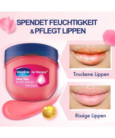 Vaseline Lip Therapy Rosy | Nourishing Lip Balm for Optimal Moisture | Shop Internationally - Buy Online on GoSupps.com