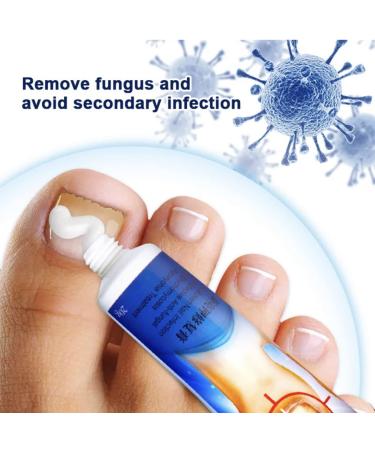 Advanced Toenail Fungus & Athlete's Foot Treatment - Restores Discolored Nails - Buy Online on GoSupps.com