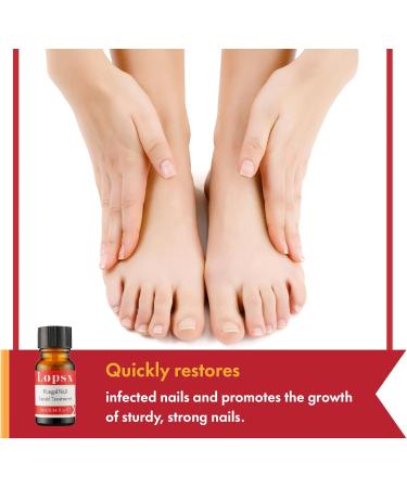 Mycose Ongles Des Pieds Lopsx Traitement Mycose Ongle Pied Puissant - Traitement Efficace pour Ongles Ab m s D color s et Fragiles 10ml - Buy Online on GoSupps.com
