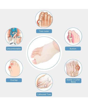 DOACT Bunion Corrector with Silicone Gel - Orthopedic Hallux Valgus Relief for Men and Women - Toe Separators for Day and Night Care (Size L) - Buy Online on GoSupps.com