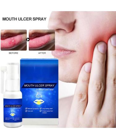 Mouth Spray for Soothing Relief | Mouth Ulcer & Sores Care | International Shipping - Buy Online on GoSupps.com