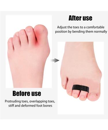 Buy Yxmeiguo Finger Straps Buddy Tape 10 Pack - No Slip Finger Splints for Broken Toe & Injured Fingers | Washable & Reusable Support - Buy Online on GoSupps.com