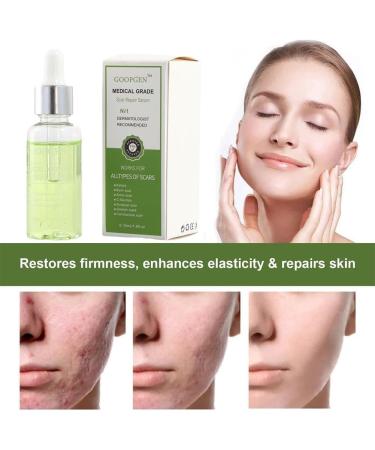 GOOPGEN Scar Repair Serum 30ml - For Acne, Stretch Marks, and Surgical Scars - Buy Online on GoSupps.com
