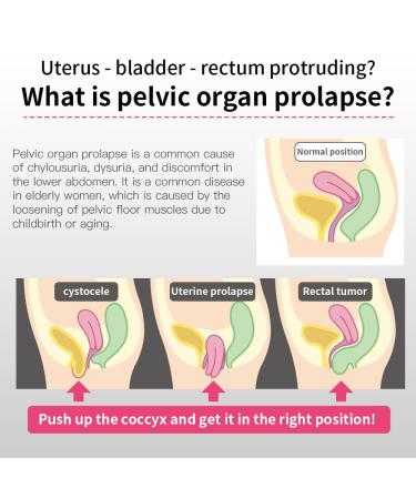 Pregnancy & Maternity Belt | Compression Groin Band for Hernia & Pelvic Pain Relief - Uterine Prolapse Support (Medium - Buy Online on GoSupps.com