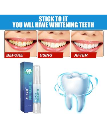 Top Dental Care Set: Alouver Tooth Products - Whitening Pen Gum Therapy Gel Tooth Alarm Essence (3 Pieces) - International Shipping Available - Buy Online on GoSupps.com
