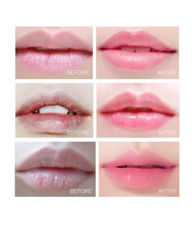 Buy 2 Box Lip Sleeping Rose Mask - Moisturizing Lip Pads & Collagen Peptide Lip Treatment for Plump Hydrated Lips | International Shipping - Buy Online on GoSupps.com