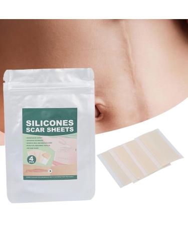 Silicone Scar Cover Up Tape for Stretch Marks - Professional Gel Sheets for Body Skin Care - Buy Online on GoSupps.com