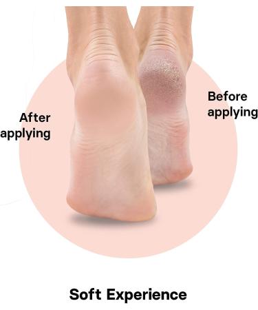 VALNEO Natural Rubber Wood Foot File - Hard Skin Remover, Callus Remover, Scrubber for Dry & Cracked Feet - Buy Online on GoSupps.com