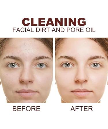 Xoermioy Purifying Balancing Massage Cream & Exfoliating Cream Set - Deep Cleansing Facial Care for Pore Perfection (2 Pieces) - Shop Internationally! - Buy Online on GoSupps.com