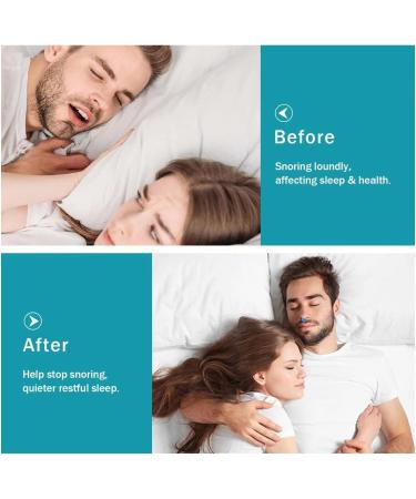 MS Esther Snore Stopper 6Pcs - Silicone Magnetic Anti Snoring Nose Clip for Quieter, Restful Sleep - Buy Online on GoSupps.com