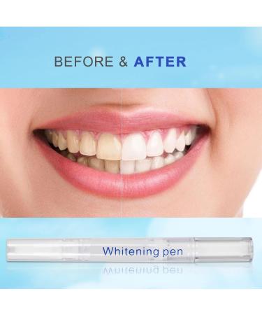 Kingheroes Teeth Whitening Pen (4 Pcs) - 30+ Uses, Effective & Painless with No Sensitivity - Travel-Friendly & Easy to Use for Beautiful White Smile - Natural Mint Flavor - Buy Online on GoSupps.com