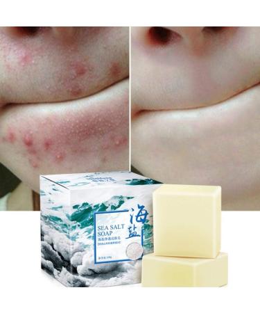 Kybbe Mite Remove Soap with Goat's Milk and Sea Salt - Eliminates Mites, Nourishes Skin - Gentle Personal Care - Buy Online on GoSupps.com