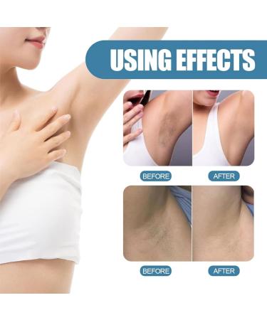 Arm Pit Brightening Cream Skin Lightening Cream Under Arm Cream For Women Body Cream For Dark Skin Bright Skin Cream Natural Underarm Lightening Cream Inner Thigh Lightening Cream - Buy Online on GoSupps.com
