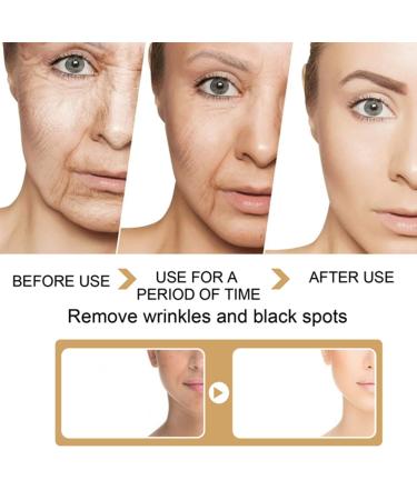 2 Pack Turmeric Dark Spot Corrector Serum Oil Repair Face Serum Natural Turmeric Bright Skin Care Moisturizing Repair Serum Oil for Face Dark Spots(30ml) - Buy Online on GoSupps.com