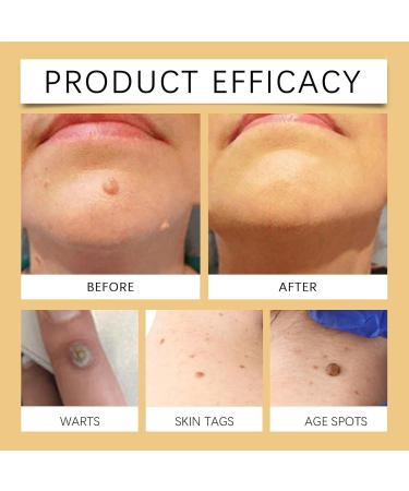 JIAOY Set of 2 bee venom skin repair creams firming and wrinkle-reducing for face and body anti-aging cream multi-action firming and moisturizing treatment - Buy Online on GoSupps.com