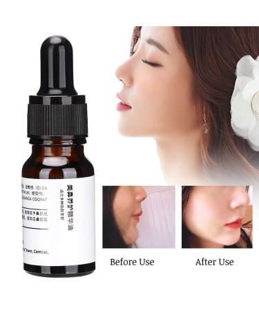 Essential Nose Repair & Reshaping: Magic Nose Up Lifting Shaper for Perfect Contours - Buy Online on GoSupps.com