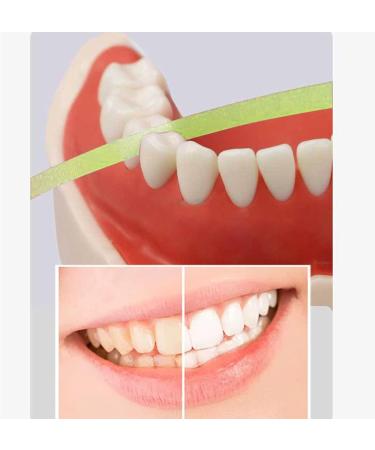 Dental Polishing Strips 20um - Teeth Abrasive Strip for Whitening and Interdental Grinding - 4mm x 6M - Buy Online on GoSupps.com