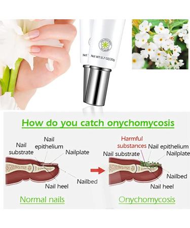 Dzhzuj Nail Treatment Repair Gel Toe Be Health Instant Beauty Gel for Nail Growth Caretoe Fungus Nail Treatment Extra Strength - Buy Online on GoSupps.com