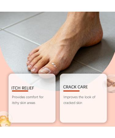 Dry Foot Cream | Non-Greasy Moisturizing Repair | Nourishing Heel Care Butter | for Cracked Feet Dead Skin Knees Elbows Body Night Day Travel Winter Men & Women - Buy Online on GoSupps.com
