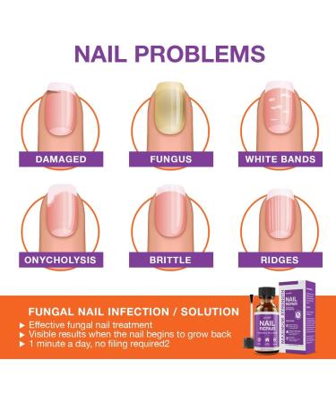 PURE GROWN BY NATURE Pureskin Nail Repair - 1.7 Oz. - Buy Online on GoSupps.com