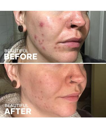 Three Ships Awake Rose Hydrosol Toner | Vegan Facial Tonic for Dry/Normal Skin | Calming & Soothing | 60mL - As Seen on Dragon's Den - Buy Online on GoSupps.com