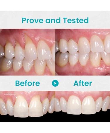 Lovilds Zefux Neslemy Dentiz & Fivfivgo Gum Therapy Gel | 2PCs for Optimal Gum Health | International Shipping - Buy Online on GoSupps.com