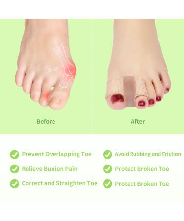 Gel Bunion Toe Separators | Silicone Spacers for Overlapping Toes | Breathable Foot Pain Relief for Men & Women - Buy Online on GoSupps.com