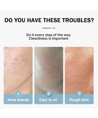 Anti Acne Face Cream Ance Gel Nourishing Formula - Buy Online on GoSupps.com