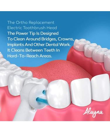 Ortho & Power Tip Bristle Replacement Heads - 20-Pack | For Oral-B Electric Toothbrush | Dupont Bristles | Interproximal Clean & Orthodontic Brushes | Retainers - Buy Online on GoSupps.com