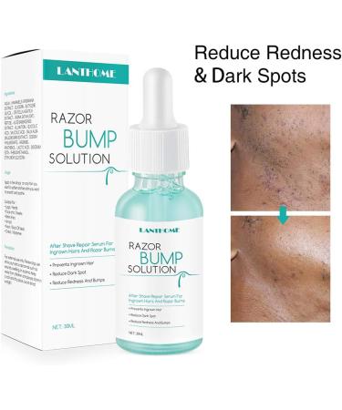 Razor Bumps Solution Skin Ingrown Hair Solution Bumps Reduce Redness Dark Spot 30ml - Buy Online on GoSupps.com