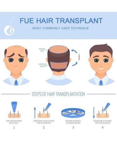 Hair Follicle Extractor Hair Transplant Treatment Growth System with 0-20000rpm Stepless Speed Regulation Safe Without Scars for Ease Helps Hair Loss Receding Hairline Thinning Hair - Buy Online on GoSupps.com