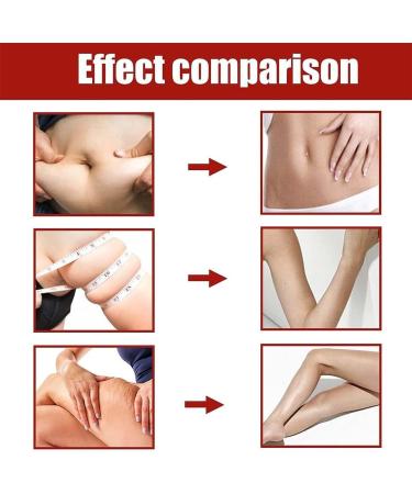 SLIMFUSETM Anti-Itch Detox Slimming Capsule 2/3/4BOX Anti-Itch Detox Slimming Capsule SLIMFUSE C psula Adelgazante Detox Anti-Picaz n- 1box/10pcs (3BOX/30PCS) - Buy Online on GoSupps.com