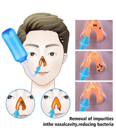 Nasal Rinse & Shower Bottle 300ml - Neti Pot Sinus Kit for Adults & Children | Blue | Fast International Shipping - Buy Online on GoSupps.com