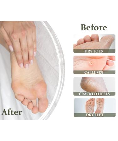 VERONA PRODUCTS Professional Foot Cream with Urea, Olive Oil, and Menthol for Dry Cracked Feet - Nourishing Dry Foot Treatment with Cooling Effect - Buy Online on GoSupps.com