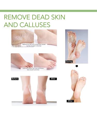 Foot Peel Mask - Exfoliating Baby Soft Skin Treatment for Men & Women | Lavender Scent - 2 Pairs - Buy Online on GoSupps.com