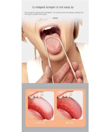 Premium Stainless Steel Tongue Scraper Set - 4 Metal Tongue Cleaners with Iron Case for Optimal Oral Hygiene - Buy Online on GoSupps.com