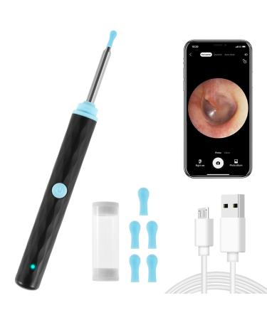 Ear Wax Remover Kit with Camera 1296P HD WiFi Earwax Camera Kit Waterproof Wireless Visual Ear Cleaner with 6 LED Lights Portable Ear Endoscope Otoscope for Adults Kids Pets.(Standard Black) Standard Black