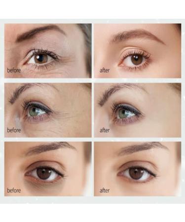 Collagen Crystal Under Eye Patches - 15 Pairs | Firming & Moisturizing Eye Mask for Puffiness & Dark Circles - International Shipping Available - Buy Online on GoSupps.com