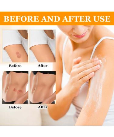 3 Bottle Bee Venom Cream | Professional Skin Correcting Cream for All Skin Types - Shop Now - Buy Online on GoSupps.com