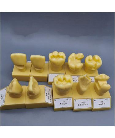 Ernzi teeth model for pedagogical - 4x enlarged dental teeth study - standards teeth preparation model - simulation oral dental teeth demonstration model