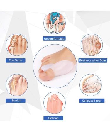 Buy Hallux Valgus Toe Spreader - 2 Pairs of Soft Gel Bunion Protectors for Men & Women | Alleviate Pain & Ensure Comfort - Buy Online on GoSupps.com