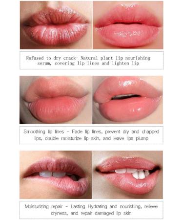 Avocado Moisturizing Lip Balm 3g Hydrating Color Change Nourishing Lip Gloss Elieve Lip Discomfort Repair Damaged Lip Muscles - Buy Online on GoSupps.com