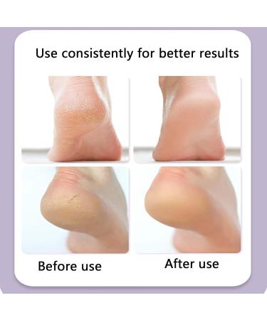 Dinghaole 1 Pair Moisturizing Exfoliating Socks - Repair Dry Cracked Heels & Soften Rough Skin - Silicone Aloe Socks for Women - Buy Online on GoSupps.com